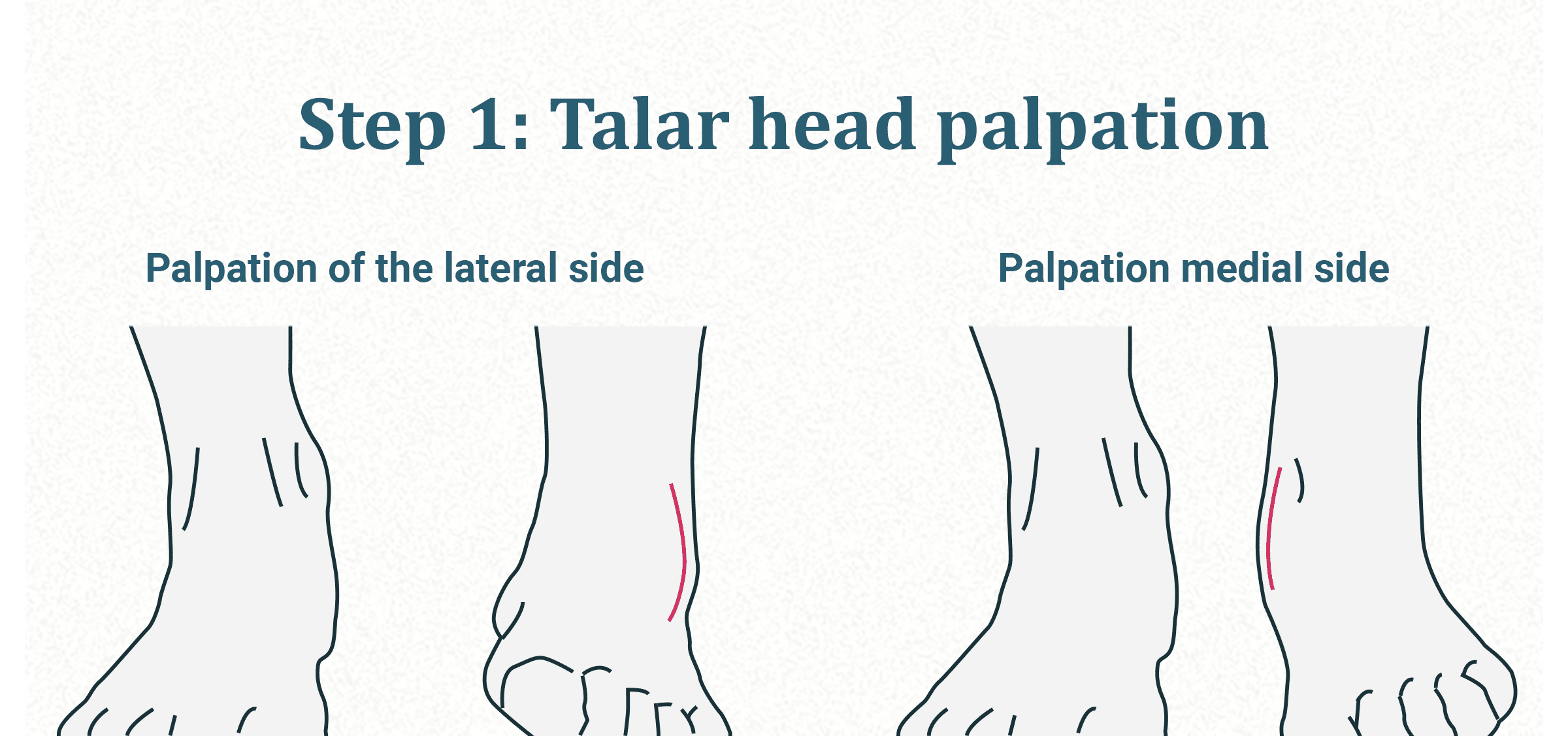 Supination og clearance pronation